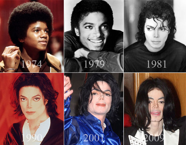 Michael-Jackson-Plastic-Surgery-Before-And-After